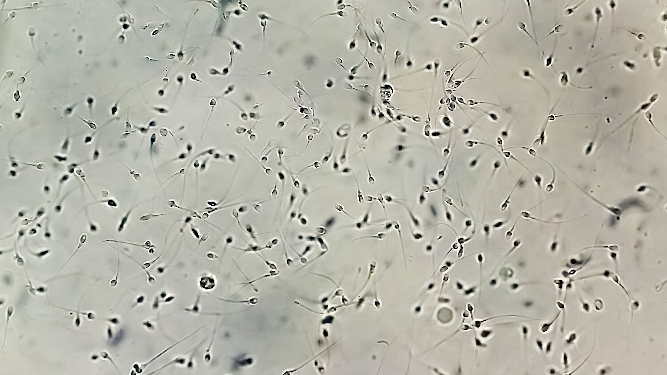 Spermaanalyse bei mikroskopischer Untersuchung | Foto: ©Arif Biswas – stock.adobe.com